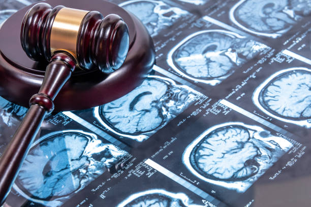 Image of gavel over X-rays of brains